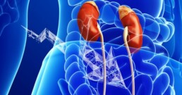 Kidneys