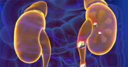 Kidneys