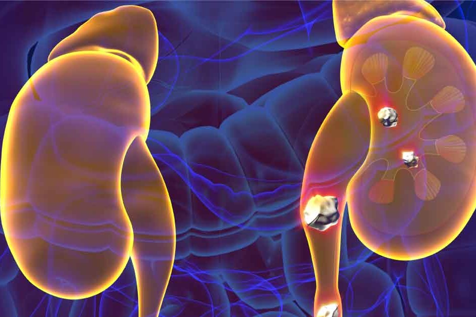 Kidneys