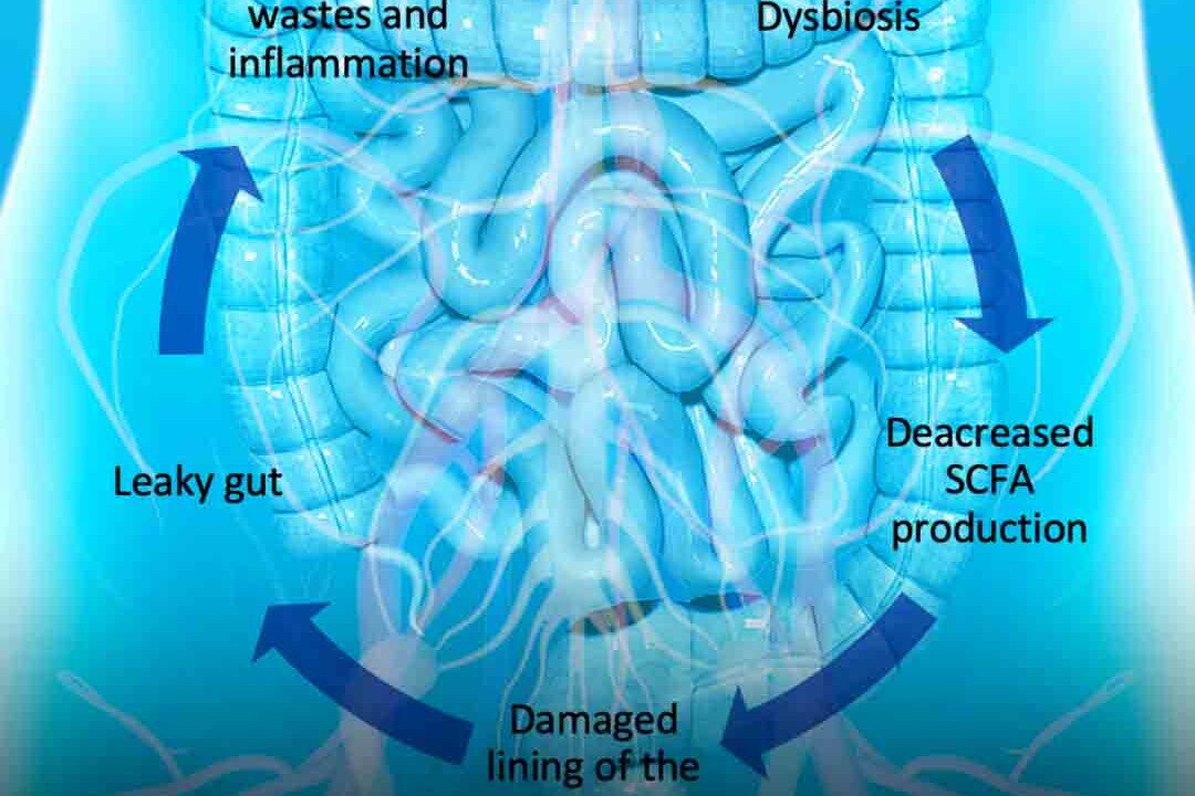 uremic toxins and the dysbiosis cycle
