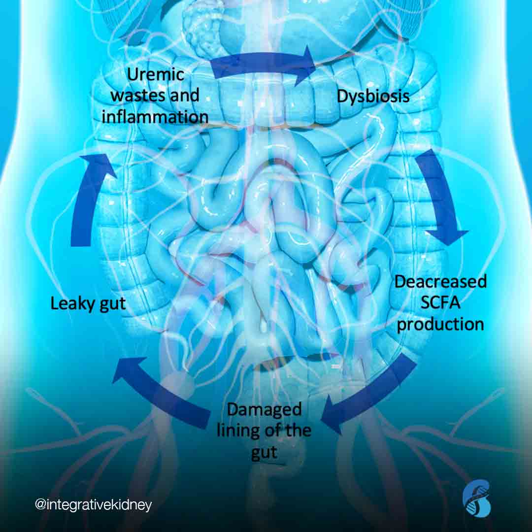The gut-kidney dysbiosis cycle