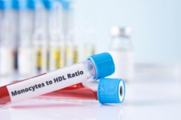 monocyte-to-HDL ratio