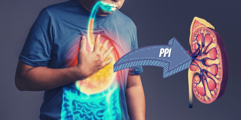 Proton pump inhibitors and kidney disease