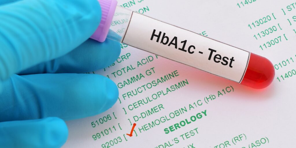Accuracy of hemoglobin A1c in CKD