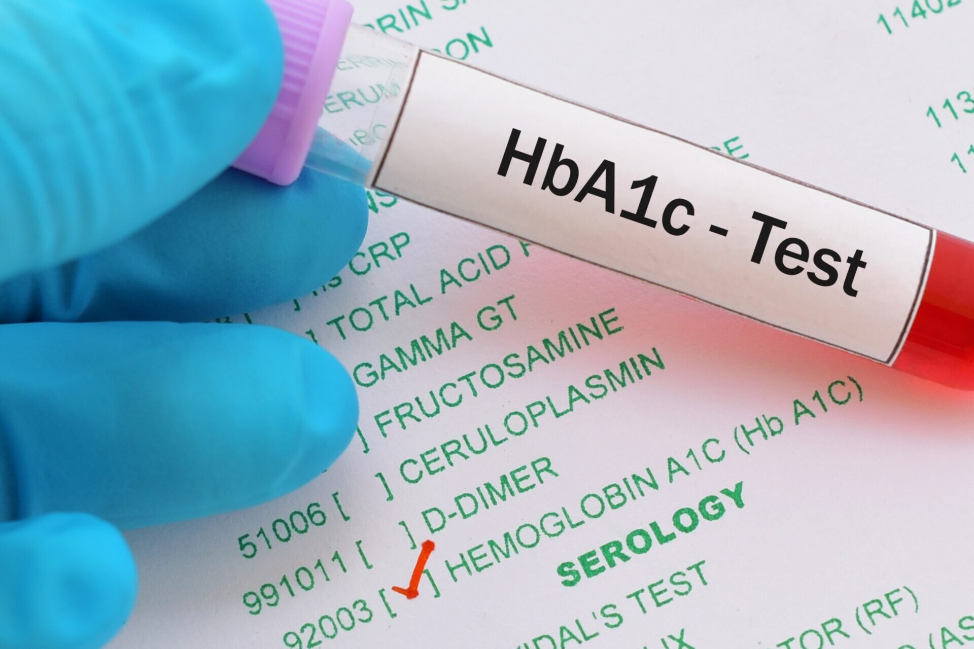 Accuracy of hemoglobin A1c in CKD