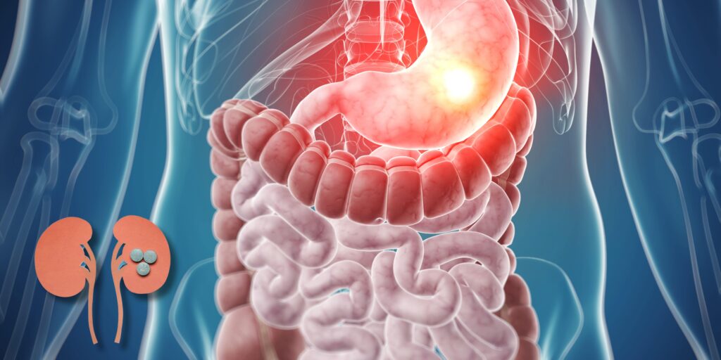 stomach medications