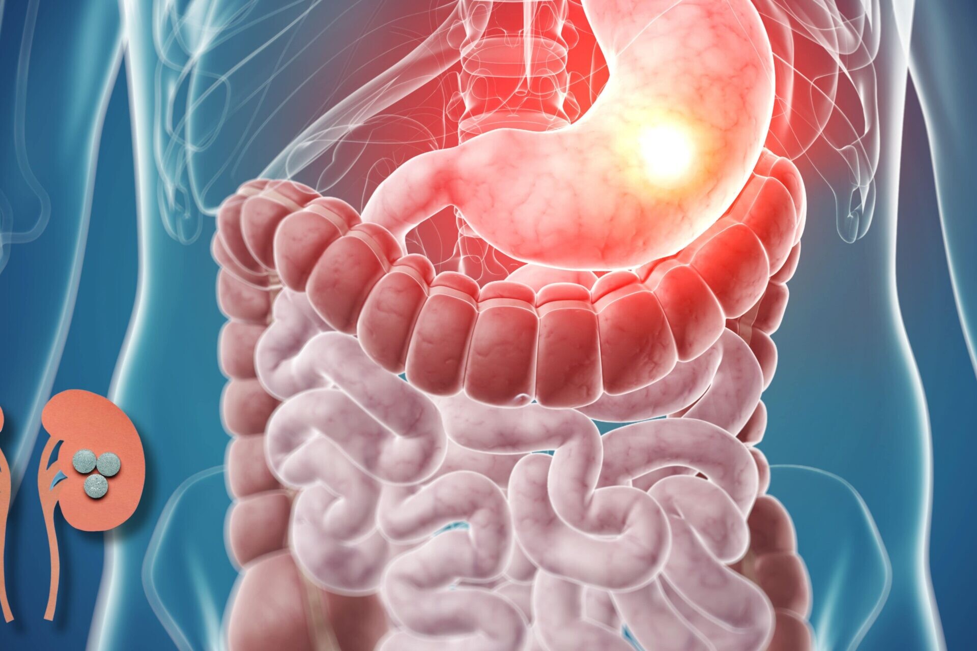 stomach medications