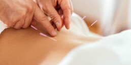 Acupuncture in Kidney Disease