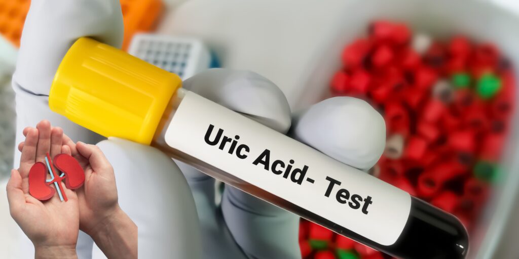 uric acid and kidney disease