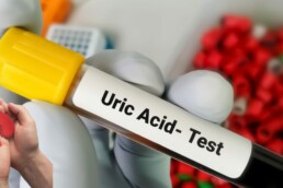 uric acid and kidney disease