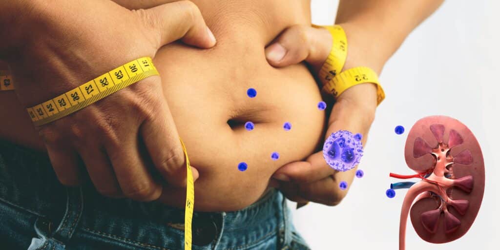 Visceral Obesity and Kidney Disease