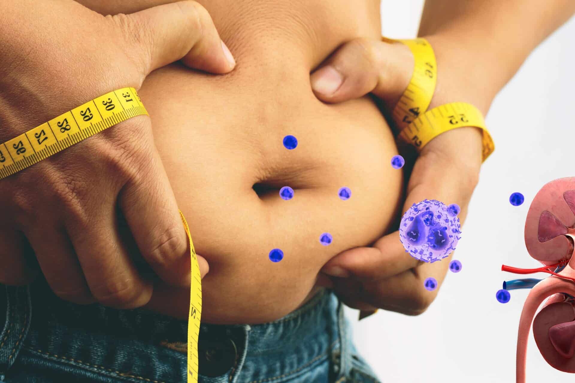 Visceral Obesity and Kidney Disease