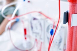 How Much Kidney Function Does Dialysis Really Replace