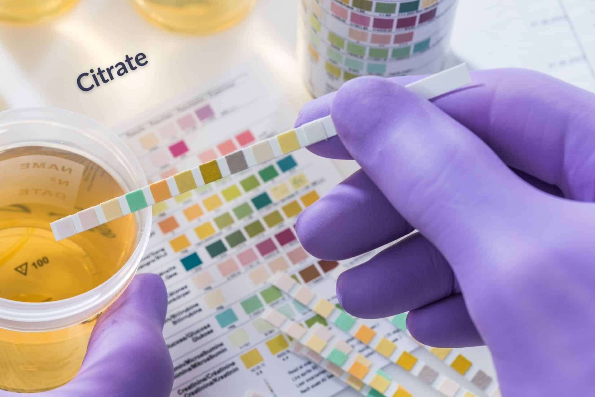 Urinary citrate