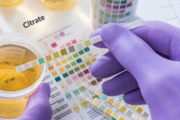 Urinary citrate